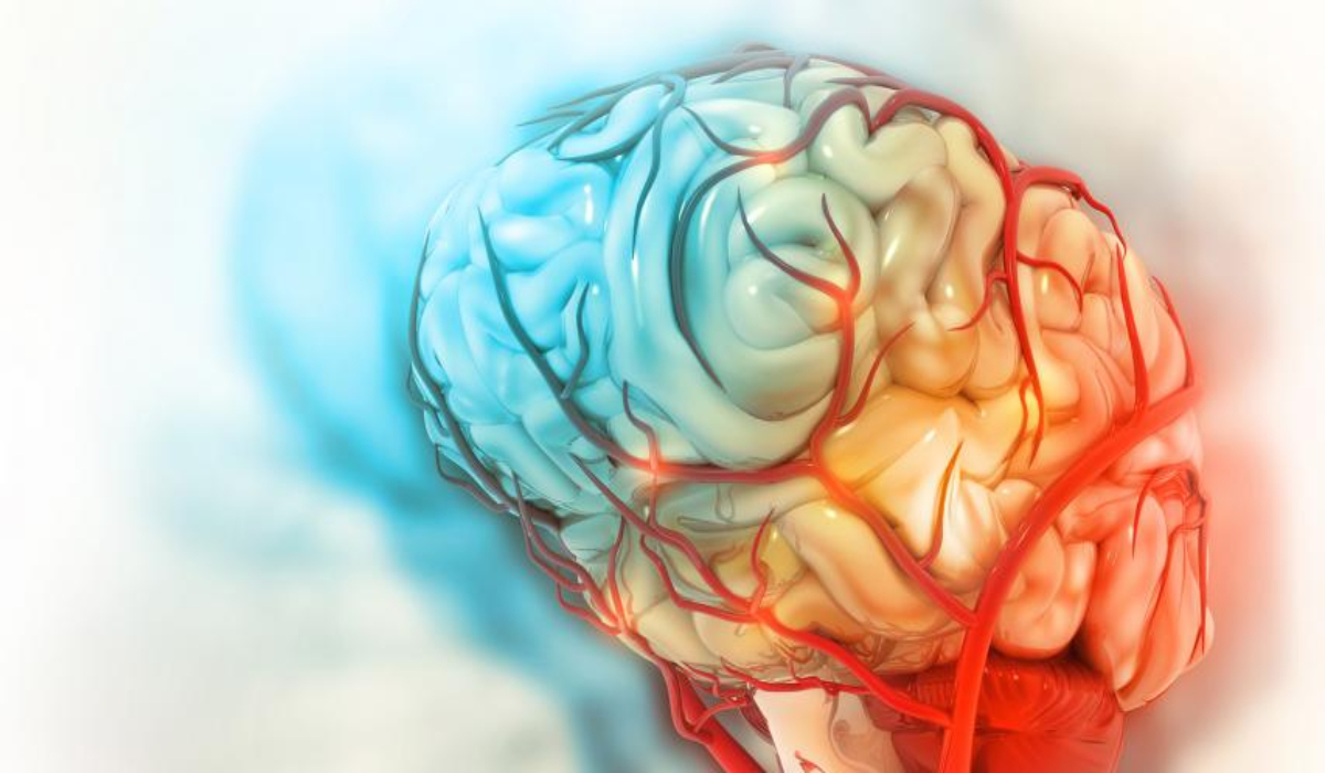 COVID-19 survivors may have loss of brain tissue